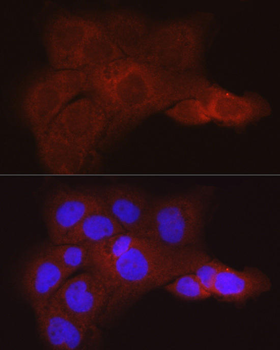 Immunofluorescence analysis of A431 cells using KRT80 Rabbit pAb at dilution of 1:50 (40x lens). Blue: DAPI for nuclear staining.