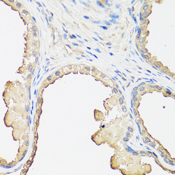 Anti-beta 2 Microglobulin Antibody [KO Validated] (CAB12404)