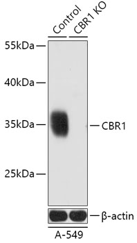 Anti-CBR1 Antibody [KO Validated] (CAB18074)