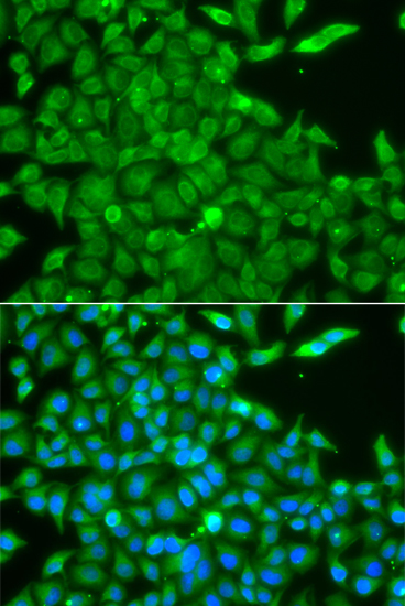 Anti-CSNK1G2 Antibody (CAB7326)