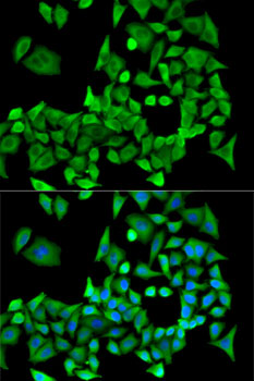 Anti-PPP2R1A Antibody (CAB5799)