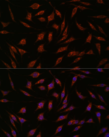 Anti-NXT2 Antibody (CAB13822)