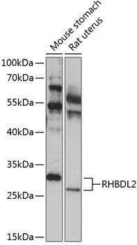 Anti-RHBDL2 Antibody (CAB14407)