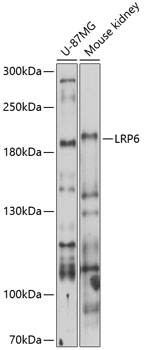 Anti-LRP6 Antibody (CAB13678)