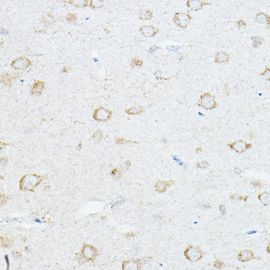 Anti-IL-1RAP Antibody (CAB5349)