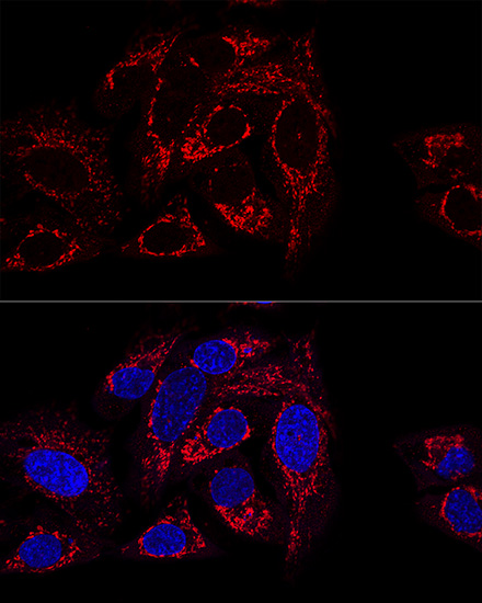 Anti-GCSH Antibody (CAB13695)