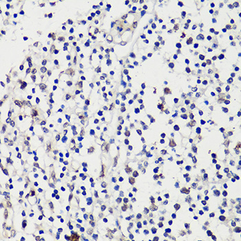 Anti-WT1 Antibody (CAB16319)