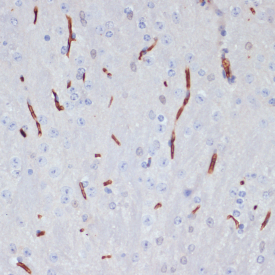 Anti-APOA1 Antibody (CAB14211)