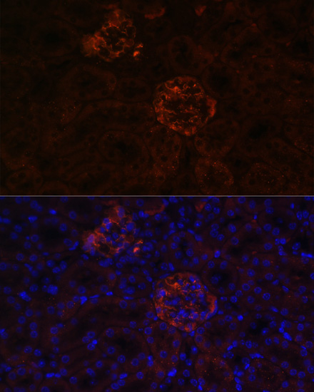 Anti-NPHS1 Antibody (CAB3048)