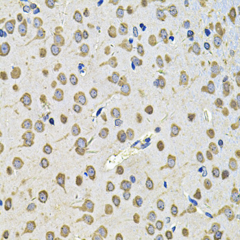 Anti-EIF3F Antibody (CAB7023)