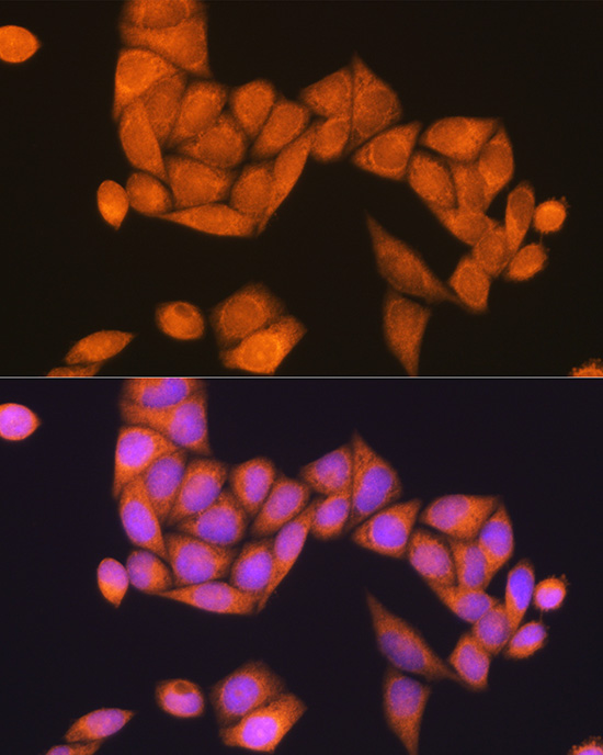 Anti-RAP1B Antibody (CAB12925)