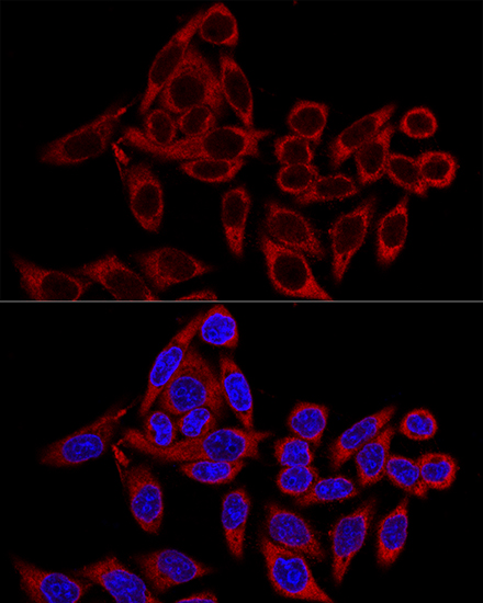 Anti-RRBP1 Antibody (CAB12239)