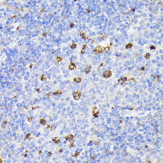 Anti-PSAP Antibody (CAB1819)