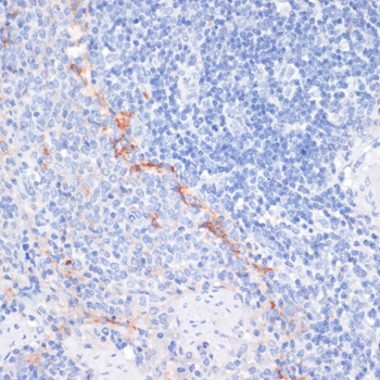 Anti-CD36 Antibody (CAB17339)