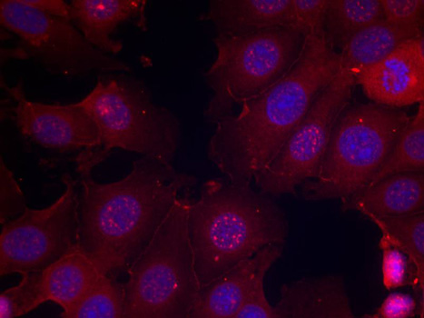 Anti-Phospho-Estrogen receptor-S167 Antibody (CABP0348)