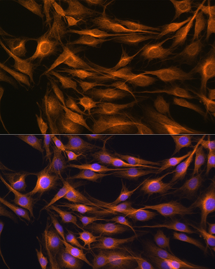 Anti-SOAT1 Antibody (CAB6311)