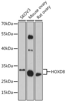 Anti-HOXD8 Antibody (CAB16877)