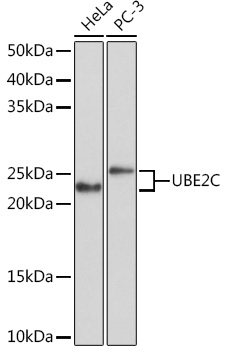 Anti-UBE2C Antibody (CAB5206)