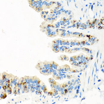 Anti-RGS5 Antibody (CAB7015)