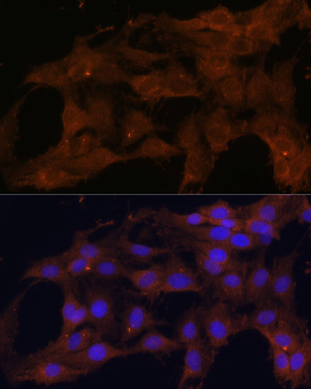 Anti-Bax Antibody [KO Validated] (CAB15633)