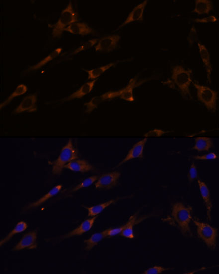 Anti-RPL7A Antibody (CAB13713)