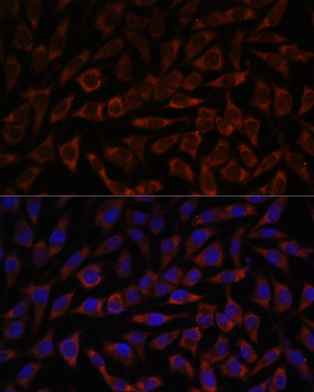 Anti-BZW2 Antibody (CAB15823)