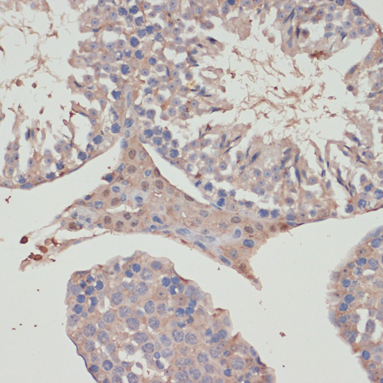 Anti-TXNRD1 Antibody (CAB16631)