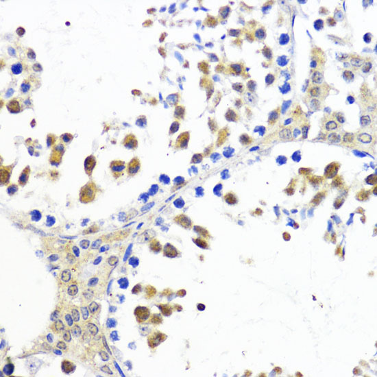 Anti-Akt2 Antibody (CAB1250)