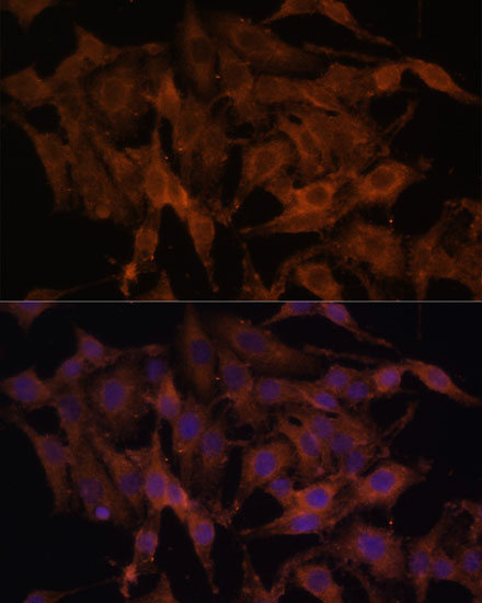 Anti-TLR3 Antibody (CAB11778)