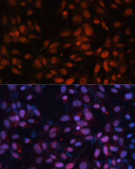 Anti-ZNF574 Antibody (CAB14923)