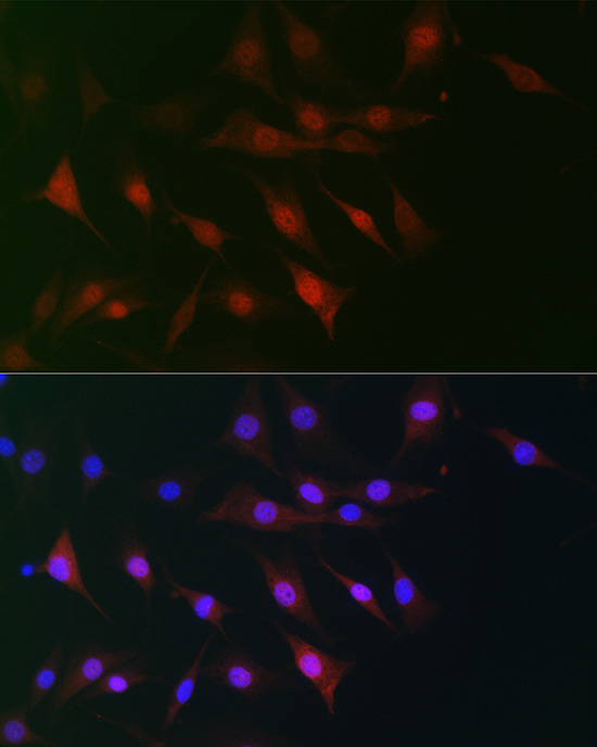 Anti-ASC / TMS1 Antibody (CAB1170)