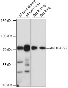 Anti-ARHGAP22 Antibody (CAB16566)