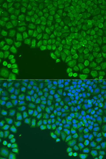 Anti-CDC42 Antibody (CAB15657)