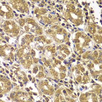 Anti-HSPE1 Antibody (CAB7437)