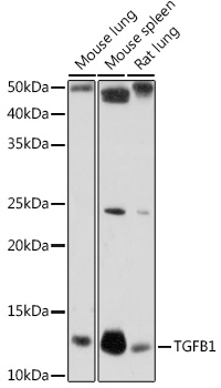 Anti-TGFB1 Antibody (CAB16640)