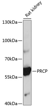 Anti-PRCP Antibody (CAB4040)