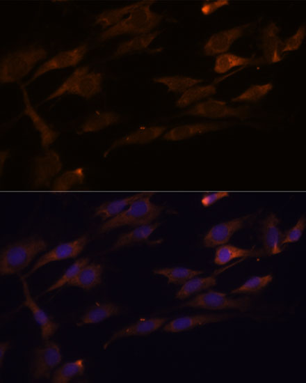 Anti-RPL7A Antibody (CAB14060)