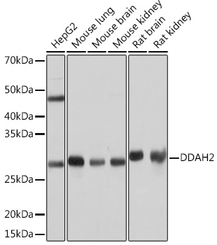 Anti-DDAH2 Antibody (CAB4159)