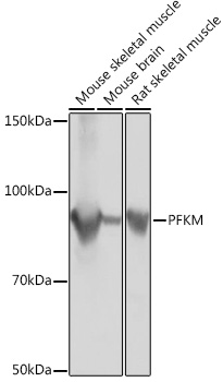 Anti-PFKM Antibody (CAB3671)