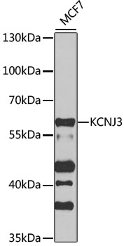 Anti-KCNJ3 Antibody (CAB12455)