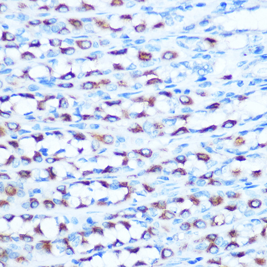 Anti-DMT1 Antibody (CAB10231)