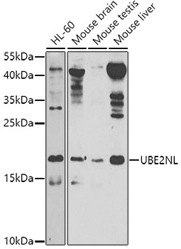 Anti-UBE2NL Polyclonal Antibody (CAB8381)