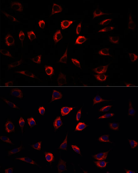 Anti-SGK1 Antibody (CAB1025)