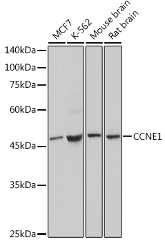 Anti-Cyclin E1 Antibody (CAB14225)