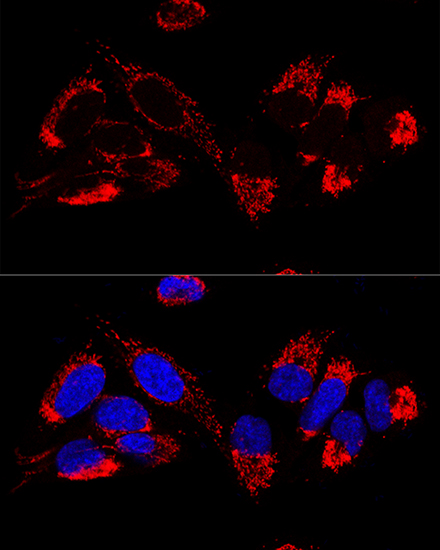 Anti-UQCR10 Antibody (CAB12587)