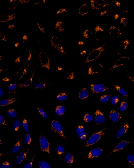 Anti-PRDX3 Antibody (CAB13074)