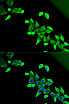 Anti-CDKAL1 Antibody (CAB5771)