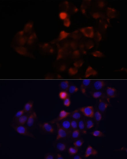 Anti-DCX Antibody (CAB14611)