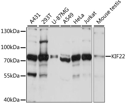 Anti-KIF22 Antibody (CAB15285)