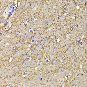 Anti-KCND3 Antibody (CAB6927)